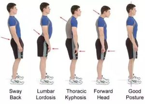  Posture provides much information regarding the natural state of their tissues. Through postural analysis it is possible to determine which areas of their body are under more strain than others, and which muscle groups are causing this strain.     Professional Analysis:   A trained eye looking at a posture picture of someone with back, neck and just about any kind of muscle or joint pain will observe asymmetry, compensations and adaptations tied to the cause of the problem by looking at:  •Alignment. Whole-body posture picture photos are taken from the front, back and side, often in front of a PostureZone assessment grid. The vertical and horizontal lines make it easy to pinpoint alignment problems, such as one shoulder that is higher than the other…one arm that is held closer to the body…a head that juts too far forward…or feet that turn in too much.  •Balance. To assess this, the professional will often ask you to perform a couple of balance exercises. For instance, you may need to stand on one foot with the other foot held off the ground, thigh parallel to the floor. This is an important part of your professional posture assessment as poor balance suggests weakness in the core, the band of muscles that encircle your midsection to connect and support the upper and lower halves of your body.  •Gait. During your assessment the posture professional often will observe how you walk. He or she will note how each foot strikes the ground…how the knees flex…and whether the head, torso or pelvis shifts to the side, or moves with symmetry.     A posture assessment typically takes about 15 to 20 minutes. Based on the results, the posture professional can then suggest an individualized Posture improvement program to improve your posture – so you can look and feel your best, and live an active, pain-free life.