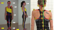 Postural assessment and correction