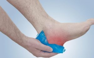 cold pack on knee for plantar fascistic