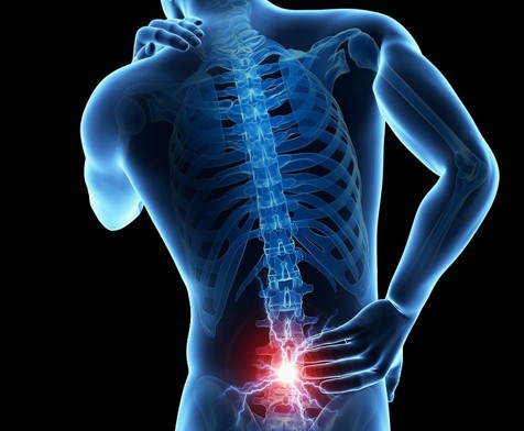 Back pain illustration
